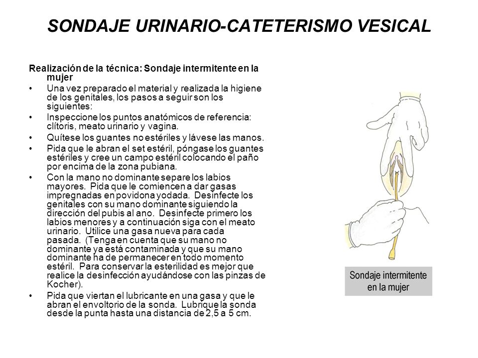catéter vesical y erección catéter vesical y erección